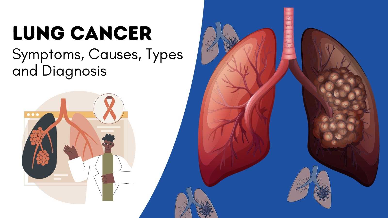 Lung Cancer Symptoms Causes Types and Diagnosis
