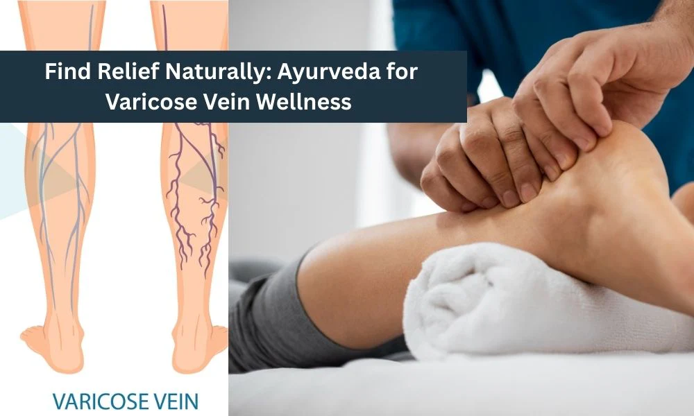 Find Relief Naturally Ayurveda for Varicose Vein Wellness 54001294 0574 4269 9b11 8eb7060f672e