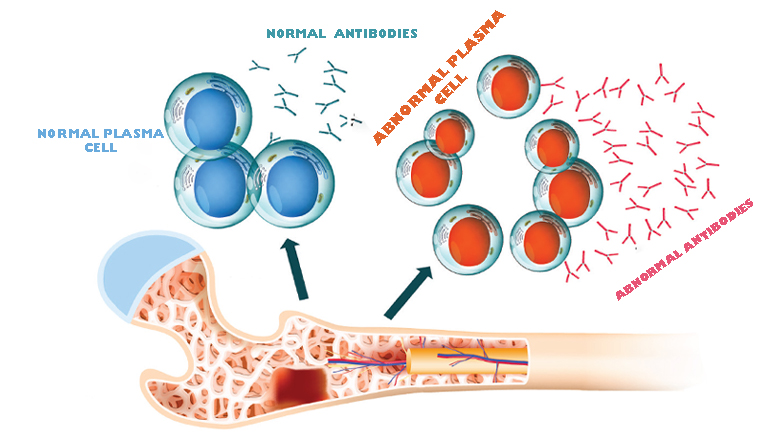 Stem Cell Treatment Of Leukemia In India